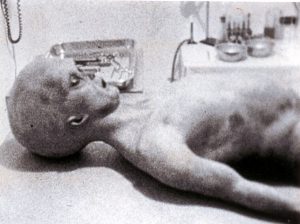 This is an alleged photo of an alleged extraterrestrial pilot found at Roswell on the autopsy table.