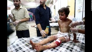 A child waits for a doctor after yet another terrifying airstrike as the civil war in Syria continues to rage with no end in sight.