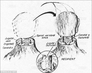 Rough sketch of what the operation will entail.